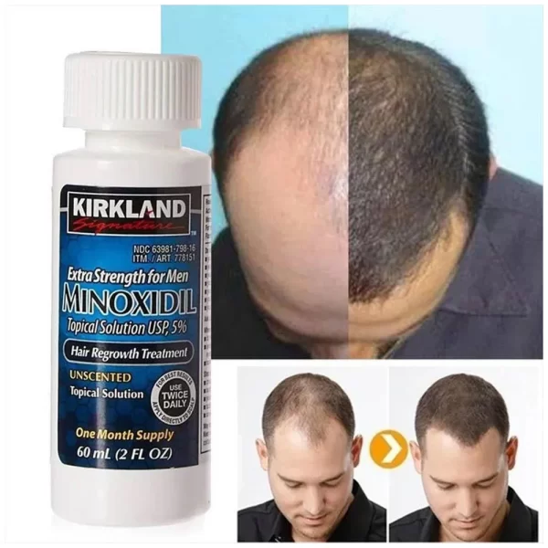 Minoxidil Kirkland 5% x6und x60ml c-u - Image 4